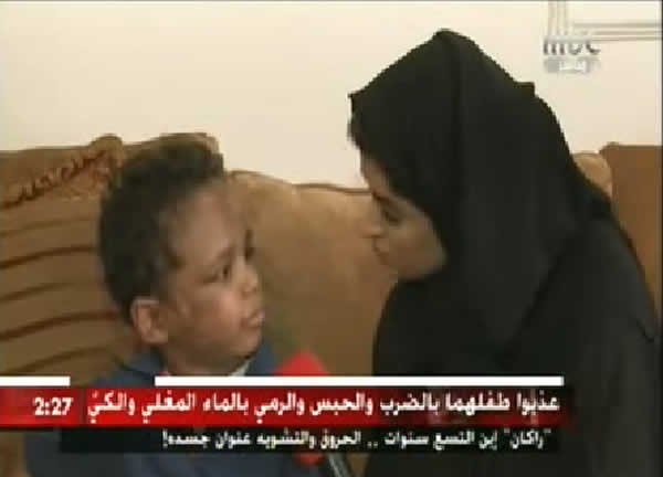 طفل يعذبونه والديه بالضرب وقلع الاضافر