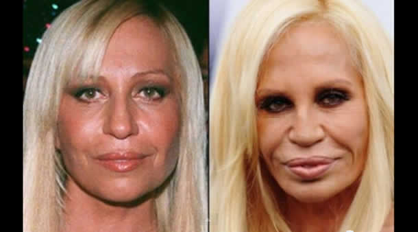 اضرار الجراحة التجميلية