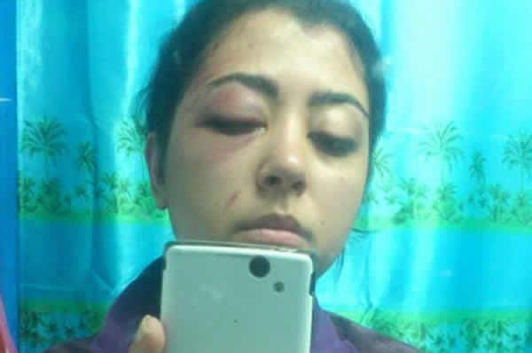 مصرية تتعرض لاعتداء بسبب حملة خلع الحجاب